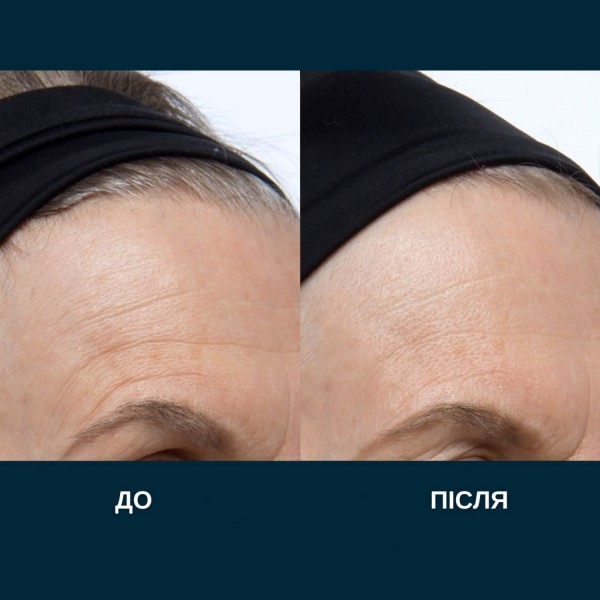 ELEMIS – Ultra Smart Pro-Collagen Enviro-Adapt Day Cream